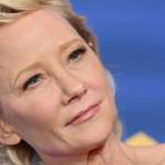 Anne Heche Autopsy Report